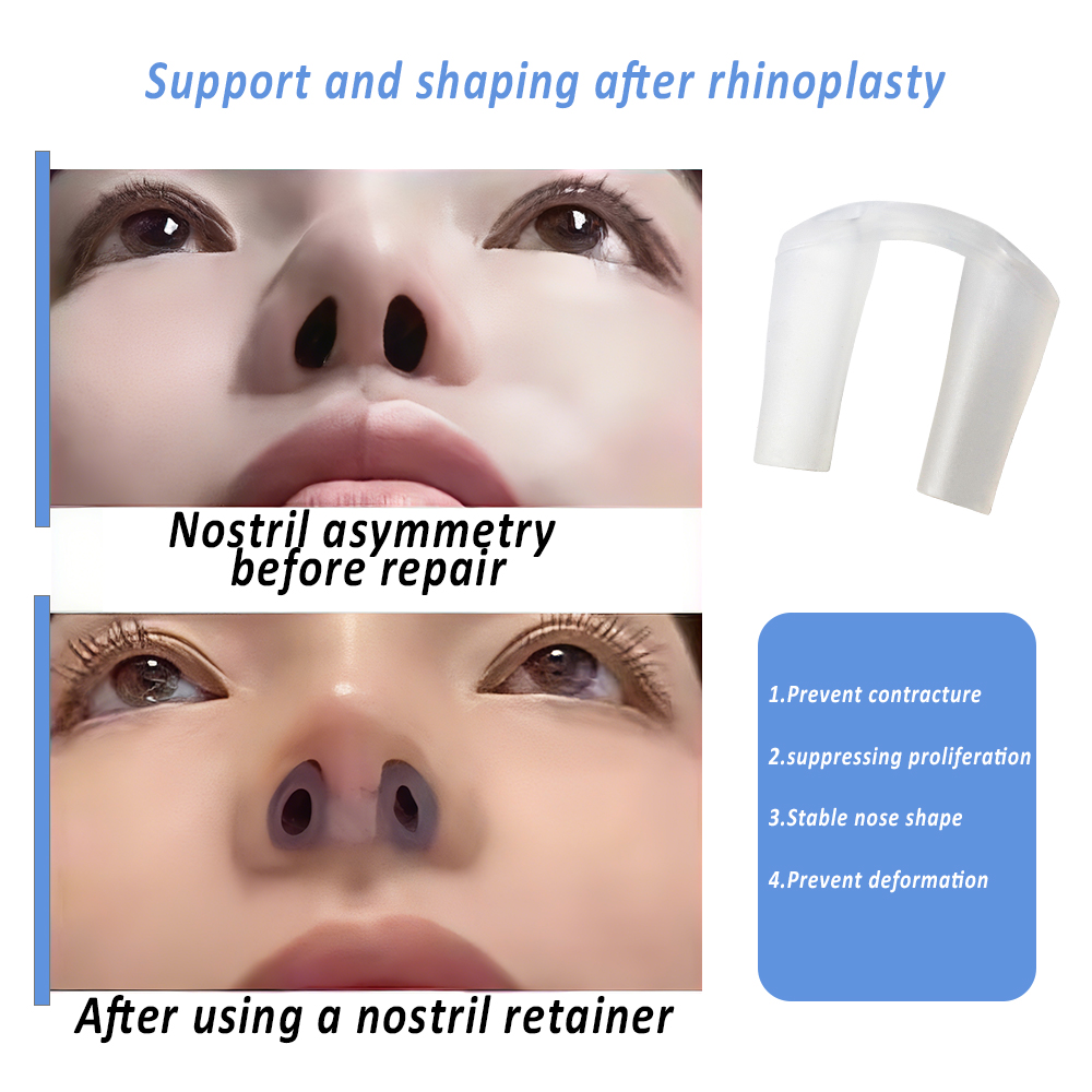 Rinoplasti İyileşme Ameliyatı  - Anti Snore Contour Pillow incelemesi ve fiyatı